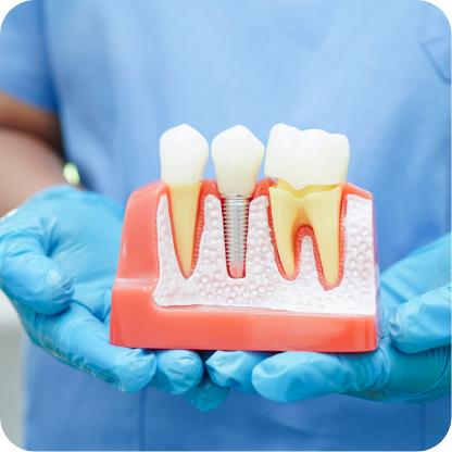 dentist holding a dental implant model