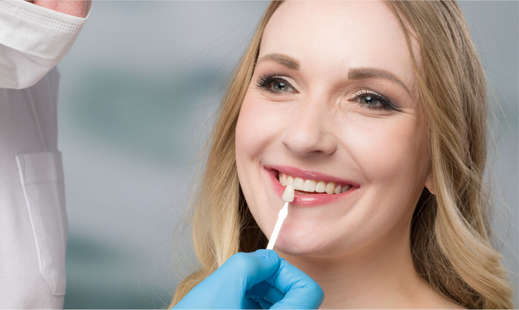 woman with dental veneers smiling as dentist matching veneer color to natural tooth